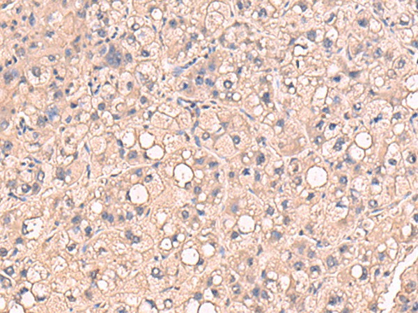 RIOK1 Polyclonal Antibody (E-AB-19072)