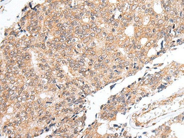PRELID1 Polyclonal Antibody (E-AB-52337)