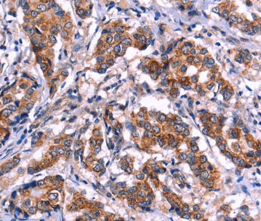 EIF2AK4 Polyclonal Antibody (E-AB-10948)