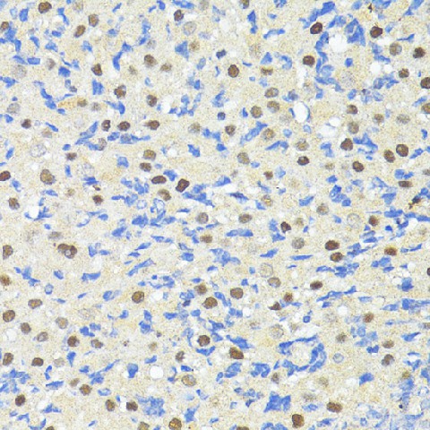 TRIM27 Polyclonal Antibody (E-AB-66677)