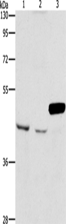 ARMCX3 Polyclonal Antibody (E-AB-14616)