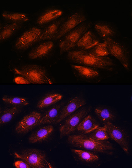 OTUB1 Polyclonal Antibody (E-AB-65829)
