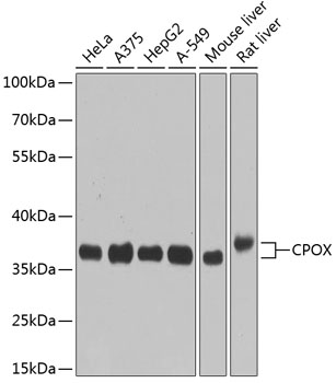 CPOX Polyclonal Antibody (E-AB-62692)
