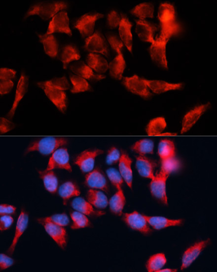 BST2 Polyclonal Antibody (E-AB-64135)