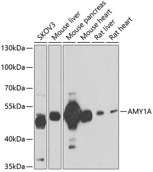 AMY1A Polyclonal Antibody (E-AB-61372)