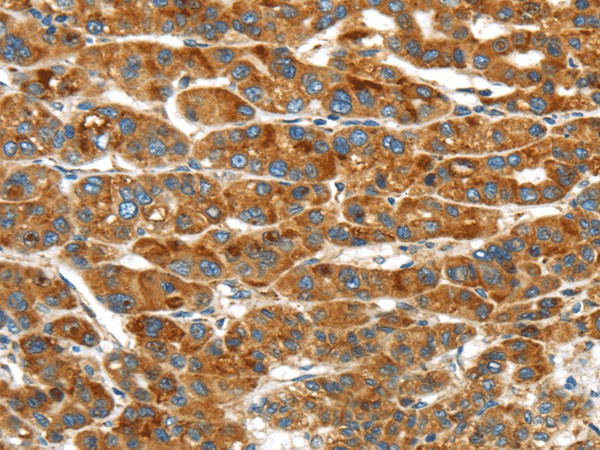 ERP44 Polyclonal Antibody (E-AB-17493)