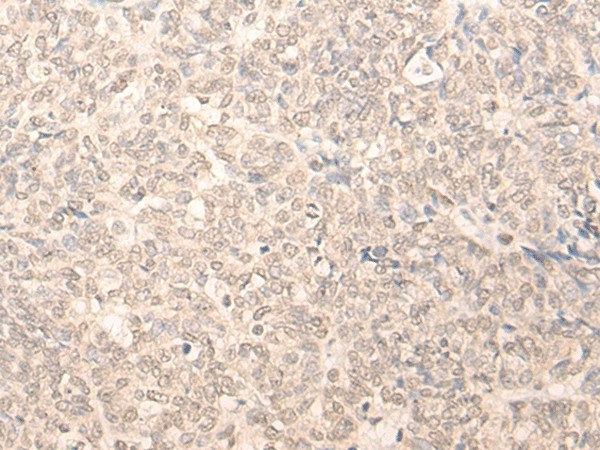 RUVBL2 Polyclonal Antibody (E-AB-52644)