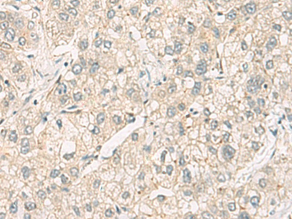 C3orf38 Polyclonal Antibody (E-AB-52504)
