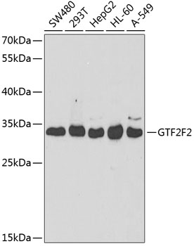 GTF2F2 Polyclonal Antibody (E-AB-61136)