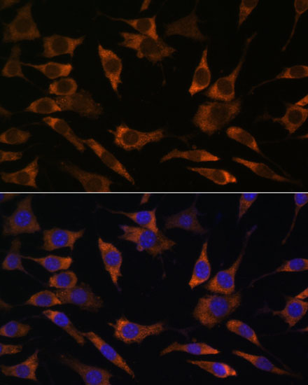 RPS25 Polyclonal Antibody (E-AB-65263)