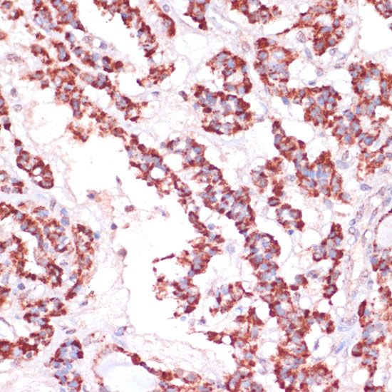 RPL24 Polyclonal Antibody (E-AB-64964)
