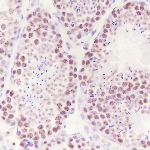 Recombinant HMGA1 Monoclonal Antibody (AN301734L)