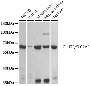 SLC2A2 Polyclonal Antibody (E-AB-68431)