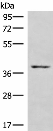 HOXD9 Polyclonal Antibody (E-AB-18094)