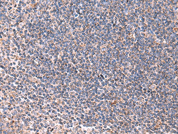 LIPA Polyclonal Antibody (E-AB-19021)