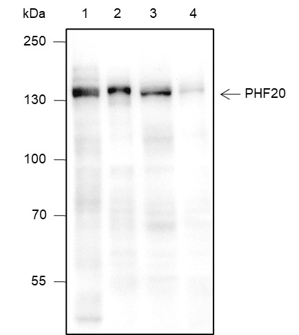 Recombinant PHF20 Monoclonal Antibody (AN301628L)