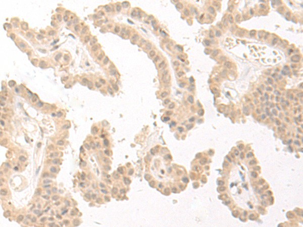 PBXIP1 Polyclonal Antibody (E-AB-18751)
