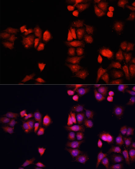 BMP1 Polyclonal Antibody (E-AB-66777)