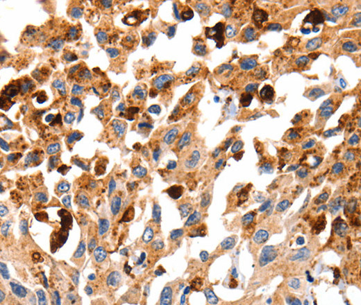 Cathepsin B Polyclonal Antibody (E-AB-13973)