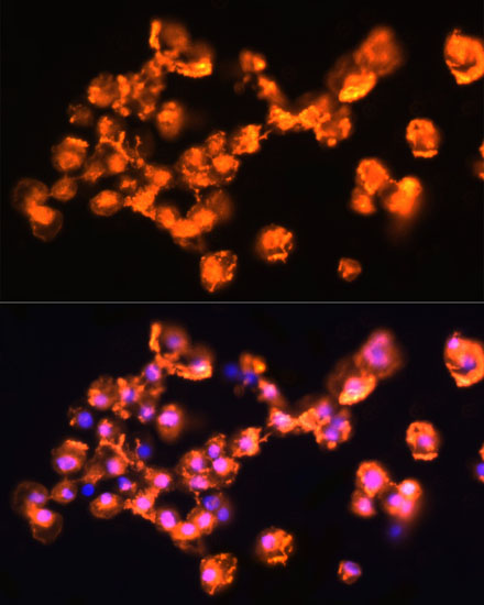 PRKCB Polyclonal Antibody (E-AB-67711)