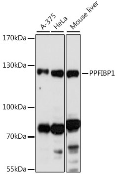 PPFIBP1 Polyclonal Antibody (E-AB-91536)