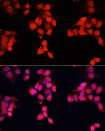 ENO3 Polyclonal Antibody (E-AB-66784)
