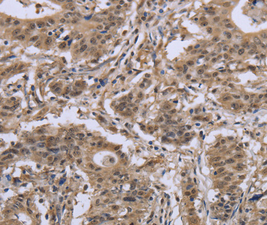 IPO8 Polyclonal Antibody (E-AB-16522)