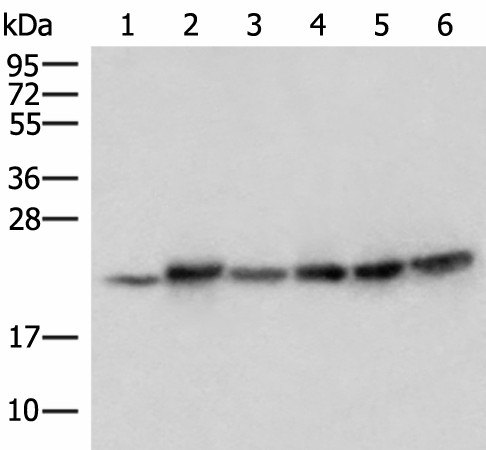 ATP5PD Polyclonal Antibody (E-AB-18971)