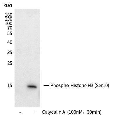 Recombinant Phospho-Histone H3 (Ser10) Monoclonal Antibody (AN300368L)