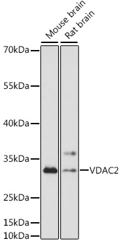 VDAC2 Polyclonal Antibody (E-AB-91493)