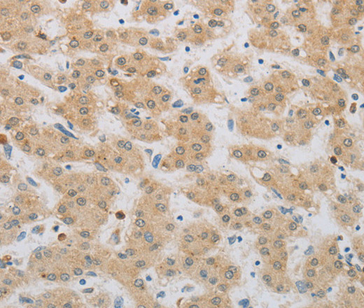 NBN Polyclonal Antibody (E-AB-15798)