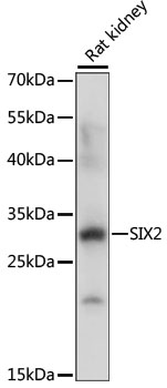 SIX2 Polyclonal Antibody (E-AB-68005)