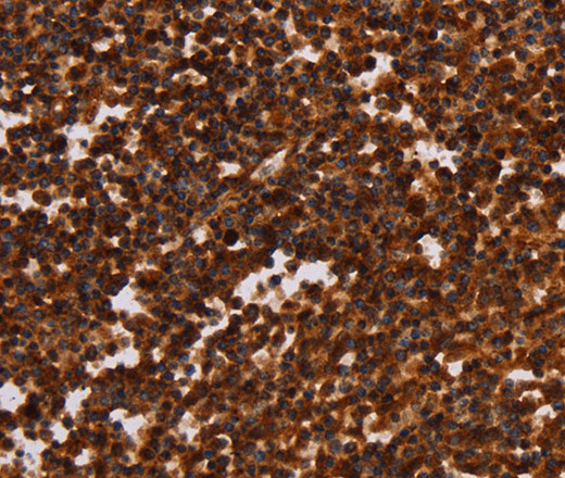 ALG11 Polyclonal Antibody (E-AB-16151)