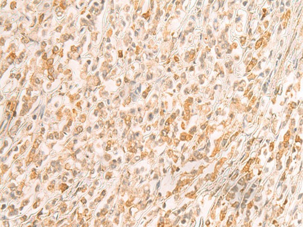 SREBF2 Polyclonal Antibody (E-AB-53273)