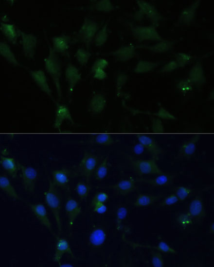 ZWINT Polyclonal Antibody (E-AB-67745)