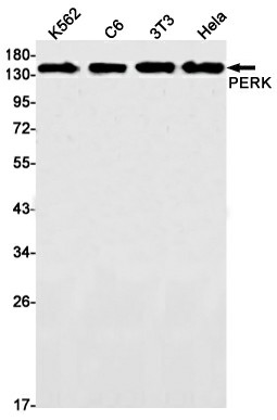 Recombinant PERK Monoclonal Antibody (E-AB-81482)