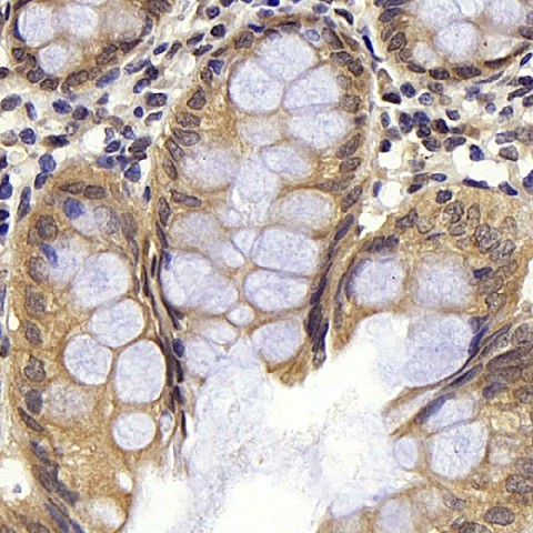 BAD Polyclonal Antibody (E-AB-70084)