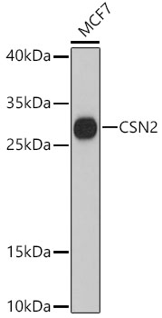 CSN2 Polyclonal Antibody (E-AB-64318)