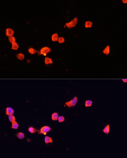CDK5R1 Polyclonal Antibody (E-AB-66296)