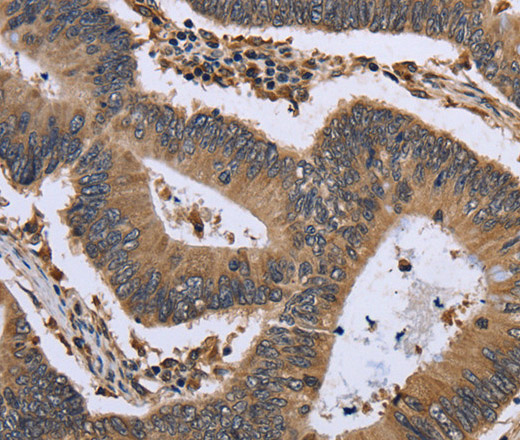 GADD45B Polyclonal Antibody (E-AB-11252)