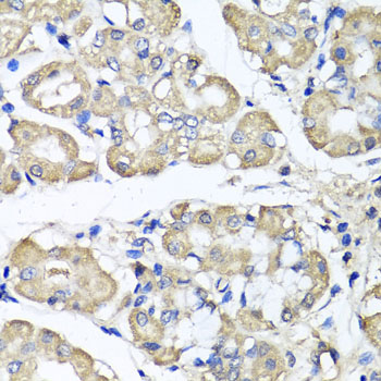 BCS1L Polyclonal Antibody (E-AB-62642)