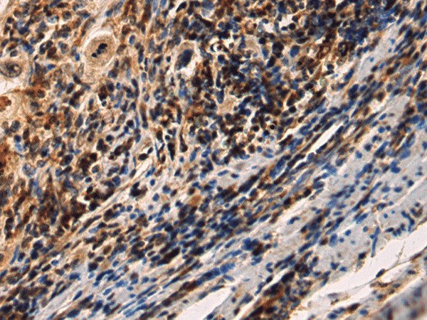 IRAK2 Polyclonal Antibody (E-AB-52156)