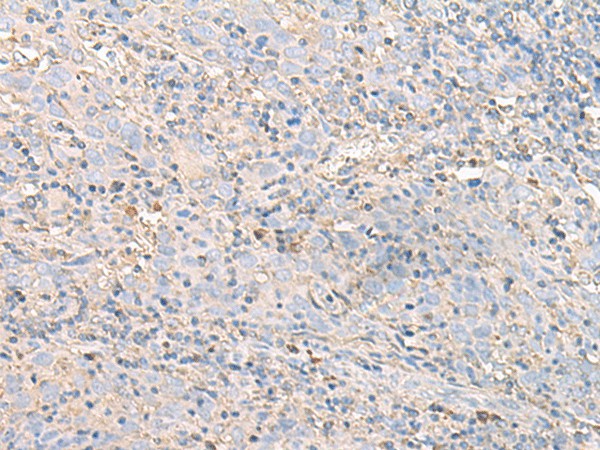 IGHA1 Polyclonal Antibody (E-AB-52649)