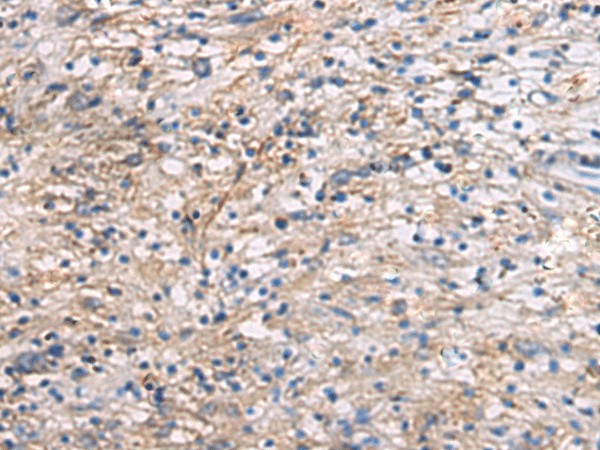 CEP89 Polyclonal Antibody (E-AB-19251)
