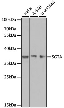 (KO Validated) SGTA Polyclonal Antibody (E-AB-61637)
