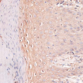 CDH3 Polyclonal Antibody (E-AB-66257)