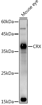 CRX Polyclonal Antibody (E-AB-92670)