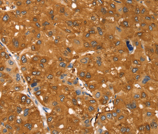 SSTR3 Polyclonal Antibody (E-AB-16077)