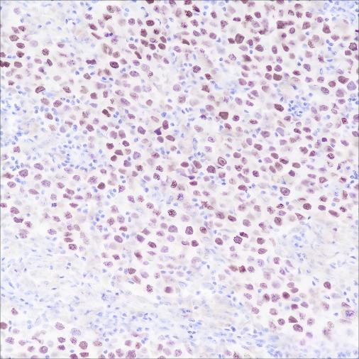 Recombinant SALL4 Monoclonal Antibody (AN301651L)
