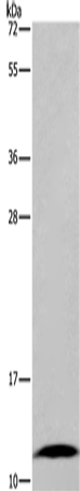 FABP6 Polyclonal Antibody (E-AB-11208)